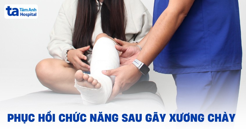 Các bài tập phục hồi chức năng sau gãy xương hiệu quả