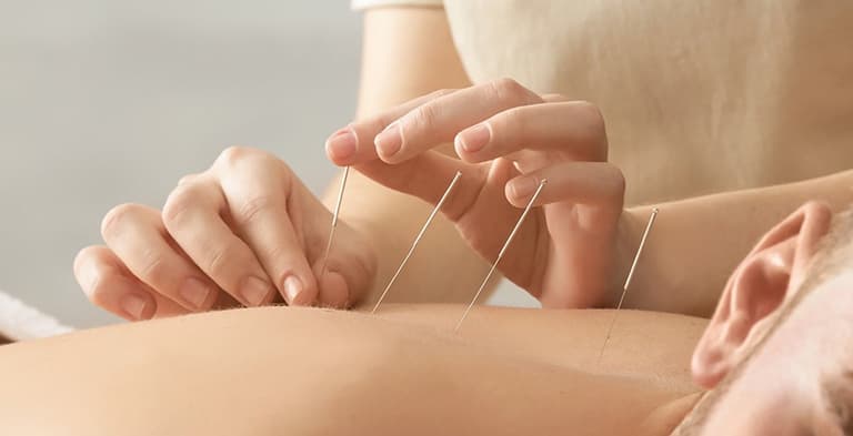 Kết hợp châm cứu với các phương pháp phục hồi chức năng khác