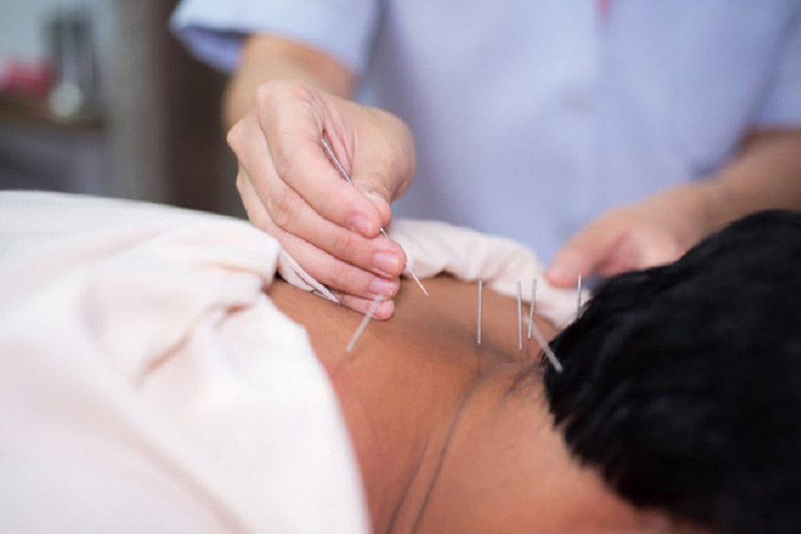 Lợi ích và hiệu quả của châm cứu trong phục hồi chấn thương